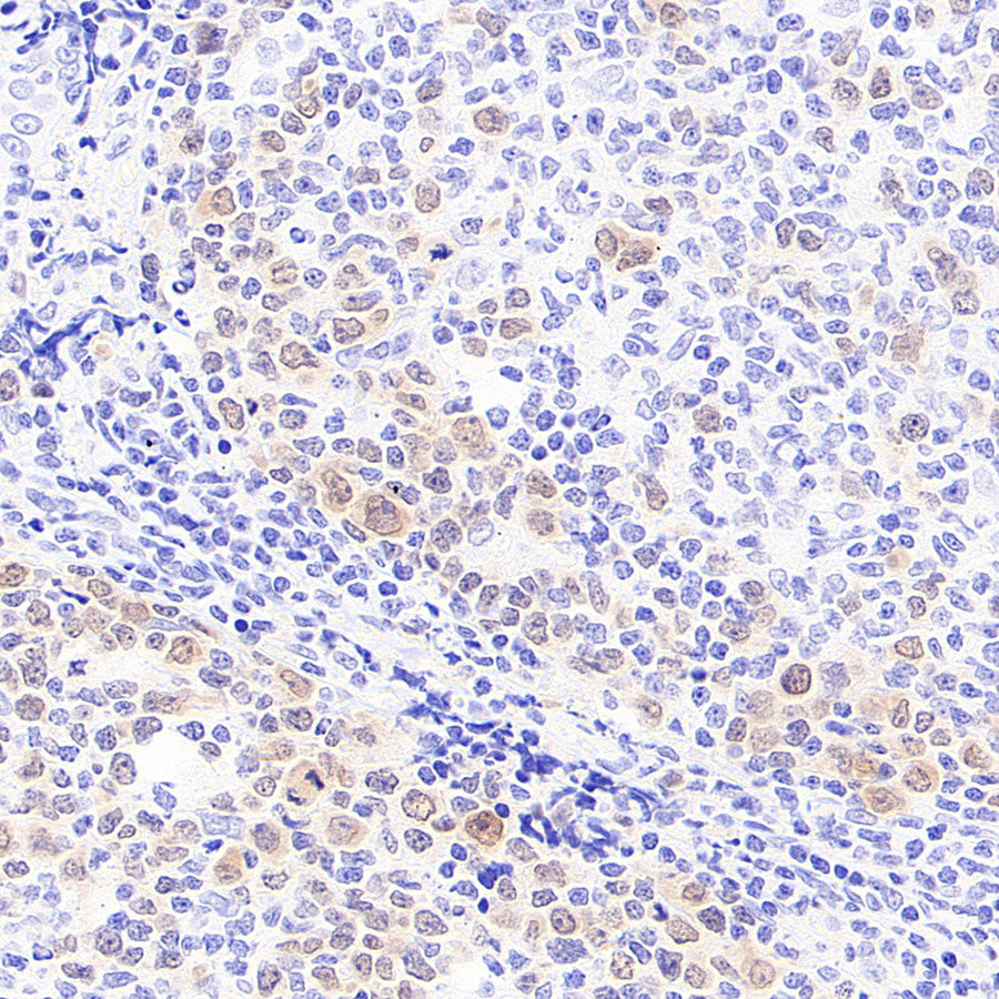 Chk1 Recombinant Mouse mAb (S-6263)