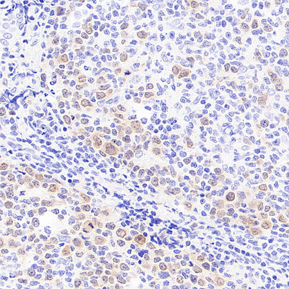 Chk1 Recombinant Mouse mAb (S-6263)