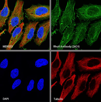 RhoA Recombinant Rabbit mAb (S-1310-159)