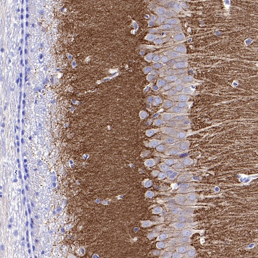 GRM5 Recombinant Rabbit mAb (SDT-2419-37)