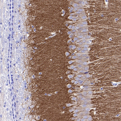 GRM5 Recombinant Rabbit mAb (SDT-2419-37)