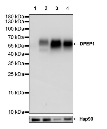 DPEP1 Recombinant Rabbit mAb (S-R293)