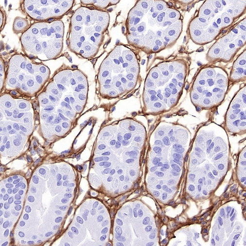 COL1A1 Recombinant Rabbit mAb (S-2975-9)