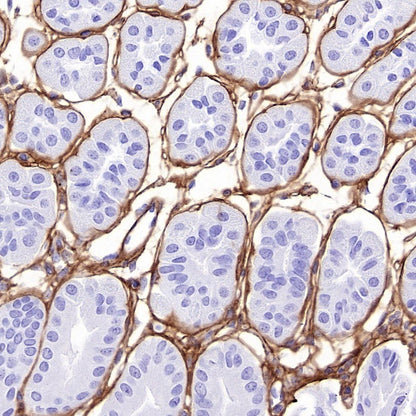 COL1A1 Recombinant Rabbit mAb (S-2975-9)