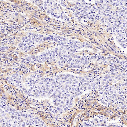 AXL Recombinant Rabbit mAb (S-2199-80)