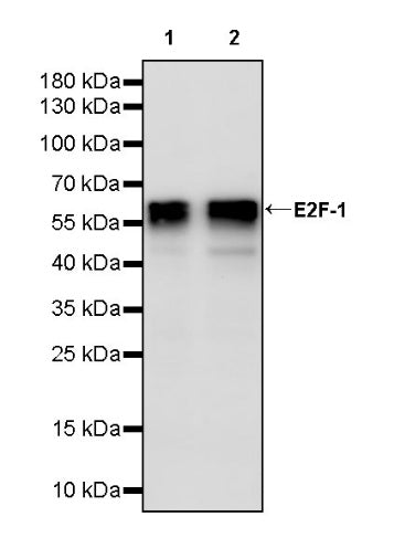 E2F-1 Recombinant Rabbit mAb (S-2580-78)