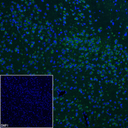 YTHDF1 Recombinant Rabbit mAb (S-3433-13)
