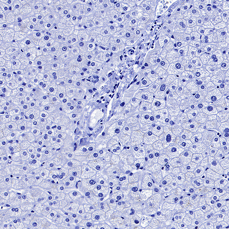 Glypican-3 Recombinant Rabbit mAb (SDT-4064-69-2)