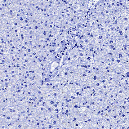 Glypican-3 Recombinant Rabbit mAb (SDT-4064-69-2)