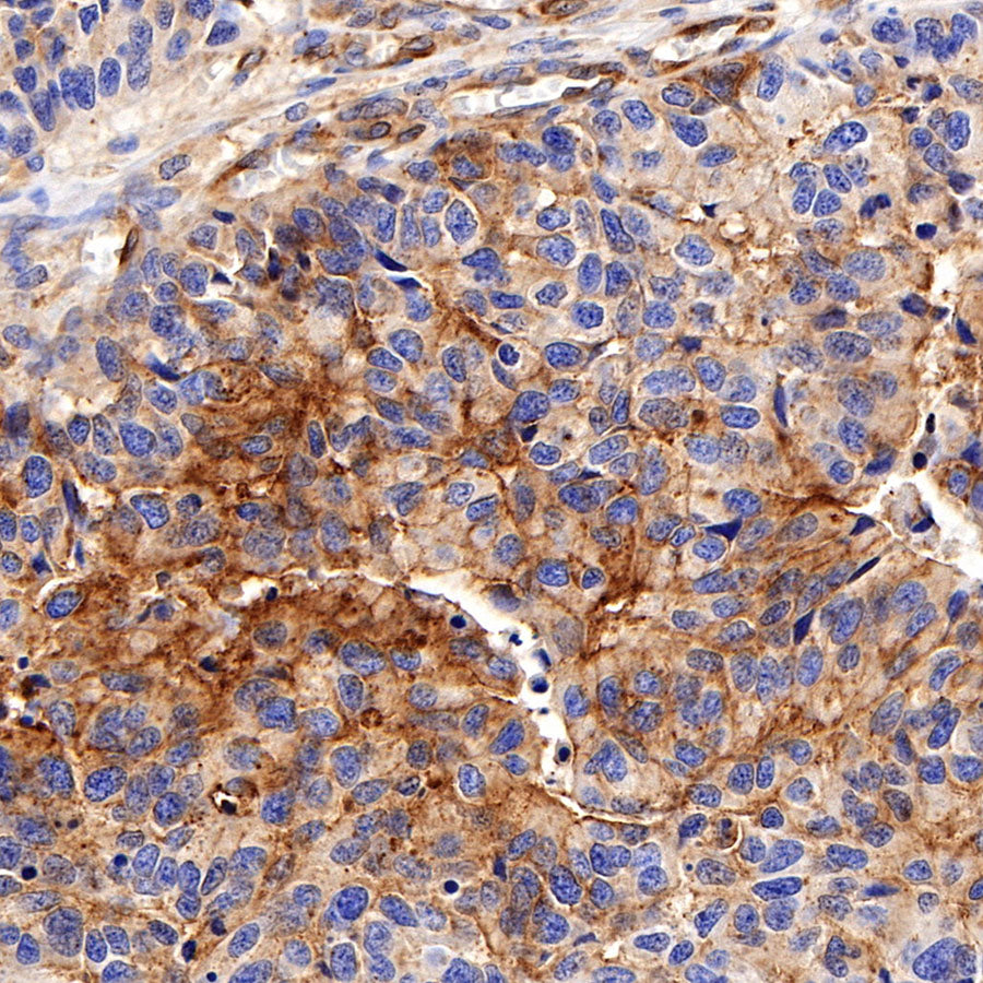 Moesin Rabbit Polyclonal Antibody