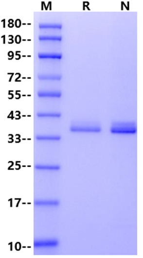 ApolipoProtein E/APOE4 His Tag Protein, Human
