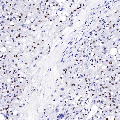 S-RMab®Steroidogenic Factor 1/SF-1 Recombinant Rabbit mAb (SDT-1666-11)