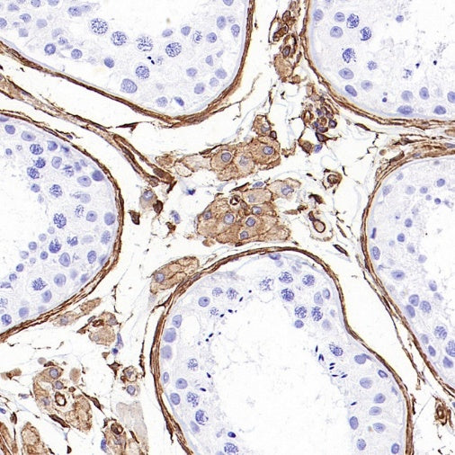 PTRF Recombinant Rabbit mAb (S-3271-13)