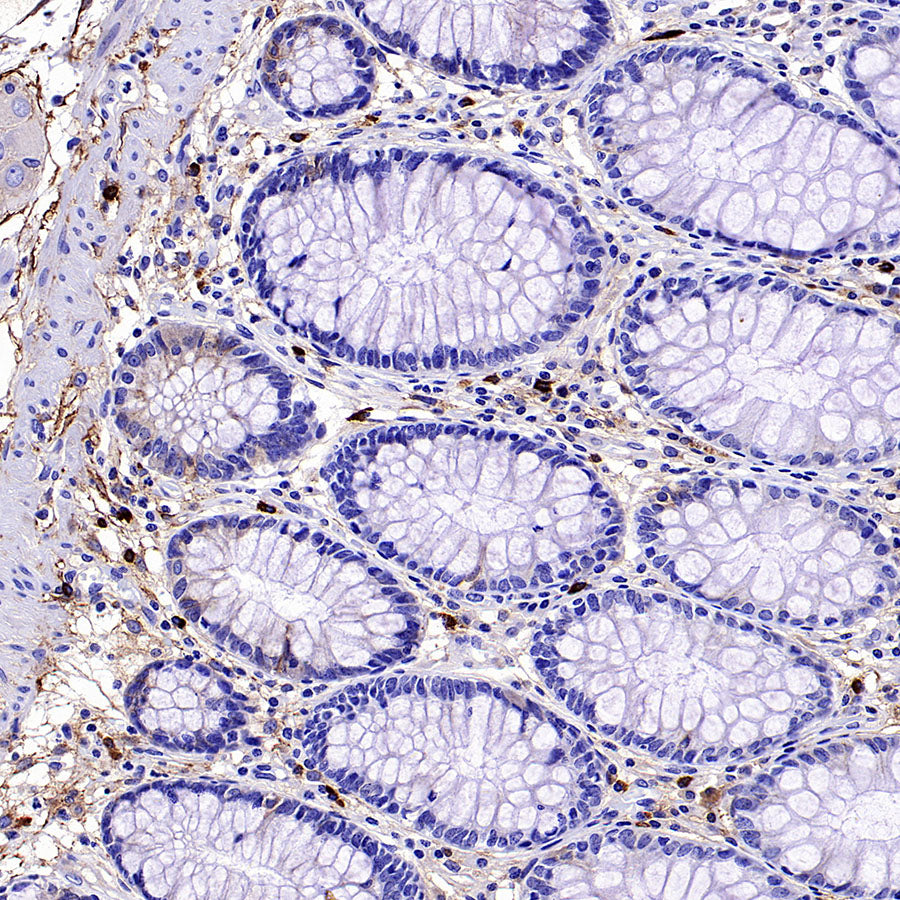 PTK7 Recombinant Rabbit mAb (SDT-2432-136)