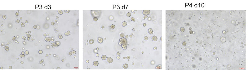 R-Spondin1/RSPO1 Protein, Human类器官培养专用
