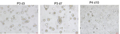 R-Spondin1/RSPO1 Protein, Human类器官培养专用