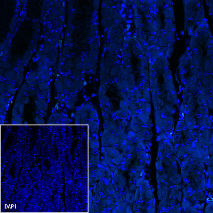 S-RMab® Helicobacter pylori Recombinant Rabbit mAb,PBS Only (SDT-R273)