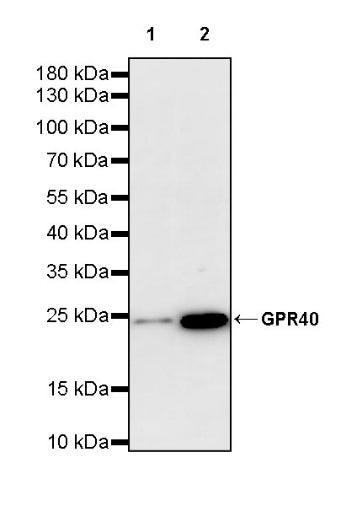 GPR40 Recombinant Rabbit mAb (S-3817-50)