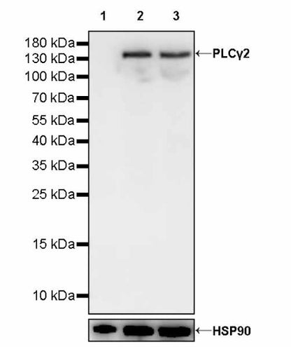 PLCγ2 Recombinant Rabbit mAb (S-2749-14)