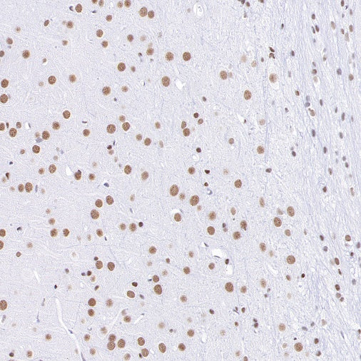 RNF40 Recombinant Rabbit mAb (S-1068-279)