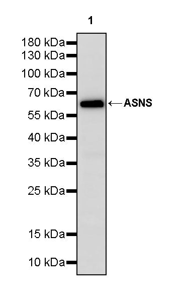 ASNS Recombinant Rabbit mAb (S-4216-14)