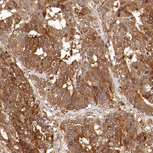 ALDH1A1 Rabbit Polyclonal Antibody
