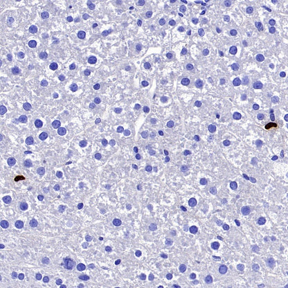 Lipocalin-2/NGAL Recombinant Rabbit mAb (S-2280-129)