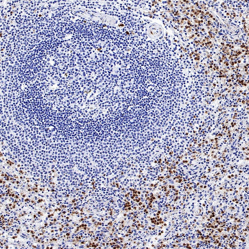 CEACAM6 Recombinant Rabbit mAb (S-720-54)