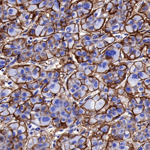 NDRG1 Recombinant Rabbit mAb (S-623-82)