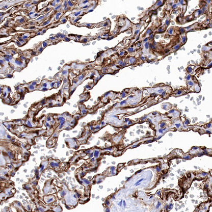 ICAM-1/CD54 Recombinant Rabbit mAb (S-906-48)