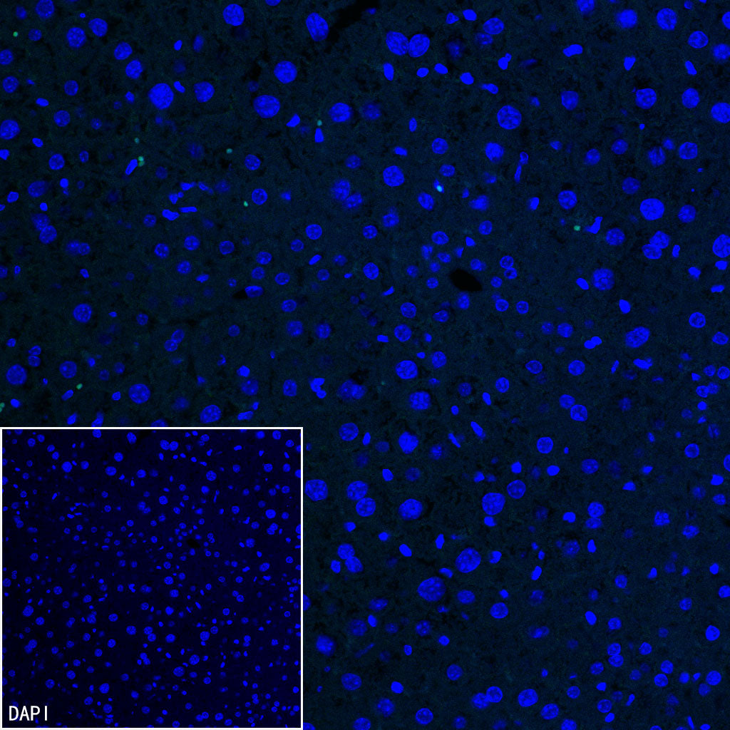 SLC7A5 Recombinant Rabbit mAb (S-4496-55)