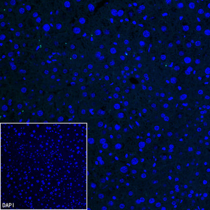 SLC7A5 Recombinant Rabbit mAb (S-4496-55)