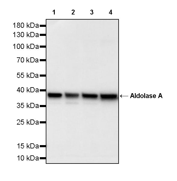 Aldolase A Recombinant Rabbit mAb (S-4007-23)