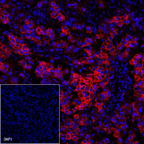 ErbB2 Recombinant Rabbit mAb (Alexa Fluor® 555 Conjugate) (S-069-57)