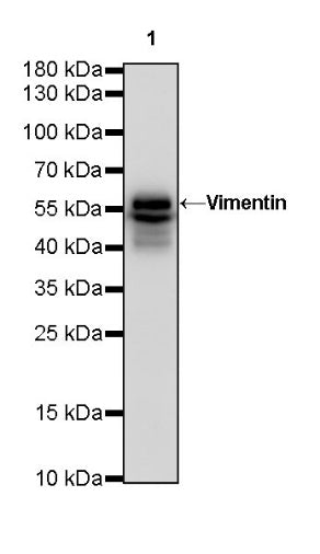 Vimentin Recombinant Rabbit mAb (SDT-029-120)