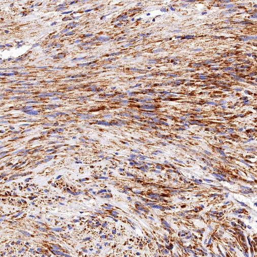 SDHB Recombinant Rabbit mAb (SDT-1162-2)