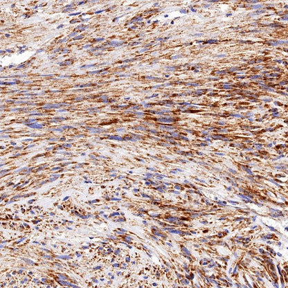 SDHB Recombinant Rabbit mAb (SDT-1162-2)