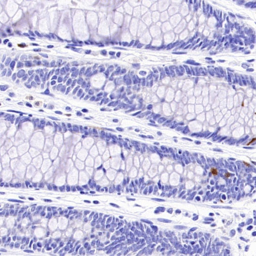 CDKN2A/p16 INK4A Recombinant Mouse mAb (SDT-4675)