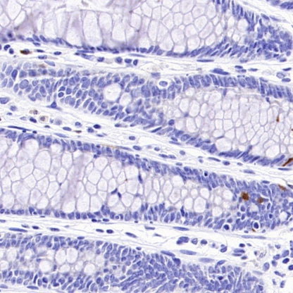 CDKN2A/p16 INK4A Recombinant Mouse mAb (SDT-4675)