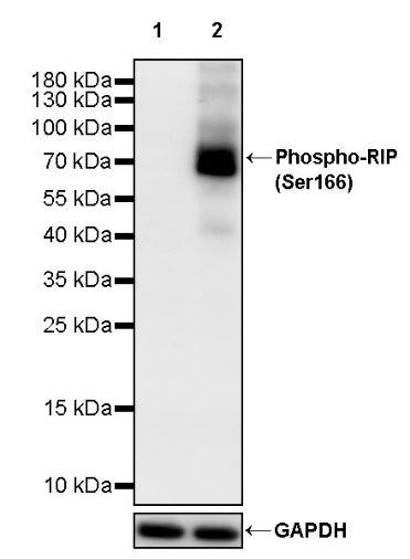 Phospho-RIP (Ser166) Recombinant Rabbit mAb (S-2702-58)