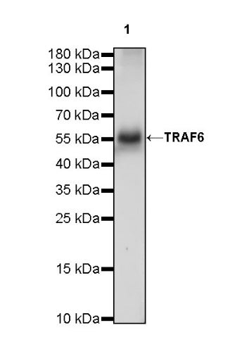 TRAF6 Recombinant Rabbit mAb (S-1087-44)