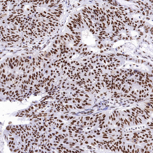 RPA70 Recombinant Rabbit mAb (S-1653-9)