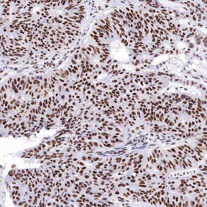 RPA70 Recombinant Rabbit mAb (S-1653-9)