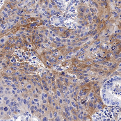 PTP1B Recombinant Rabbit mAb (S-R304)