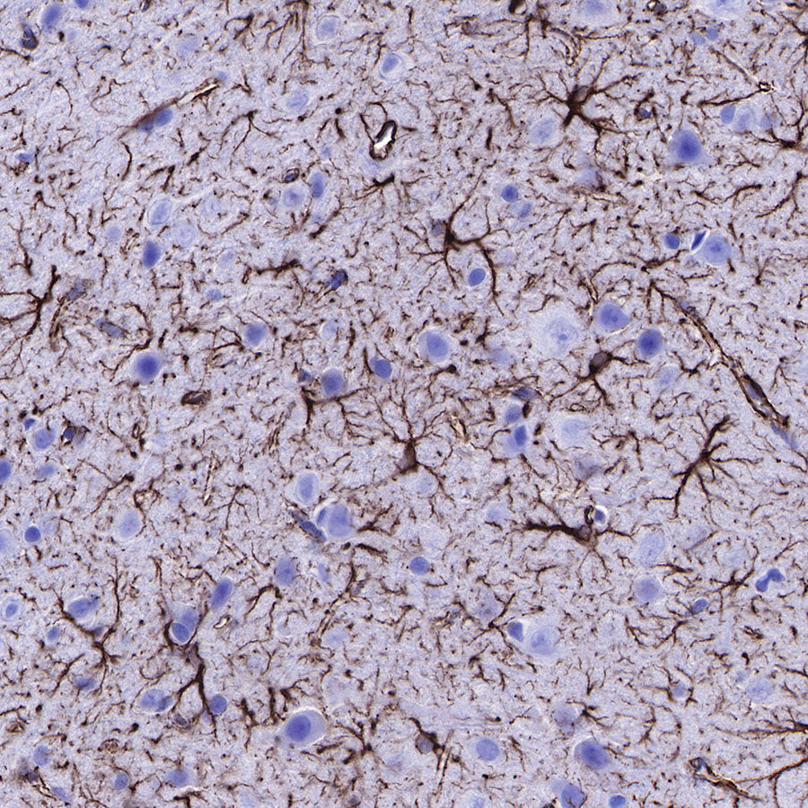 GFAP Recombinant Rabbit mAb (SDT-306-10)