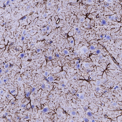 GFAP Recombinant Rabbit mAb (SDT-306-10)