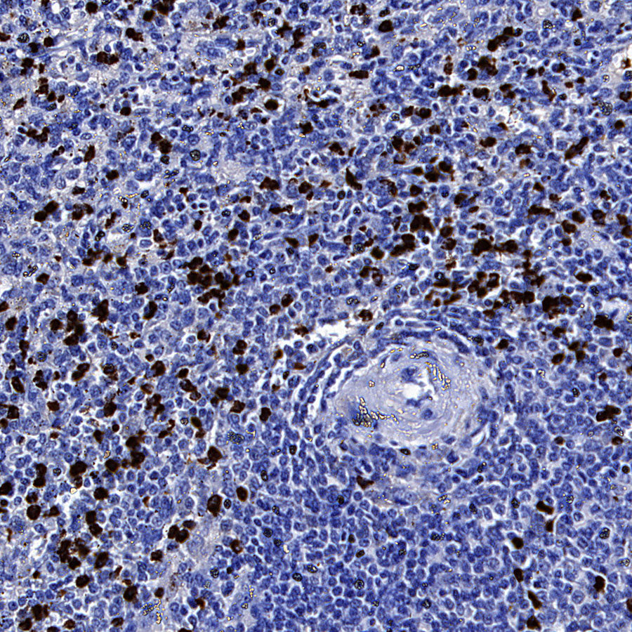 MMP-8 Recombinant Rabbit mAb (S-5674)