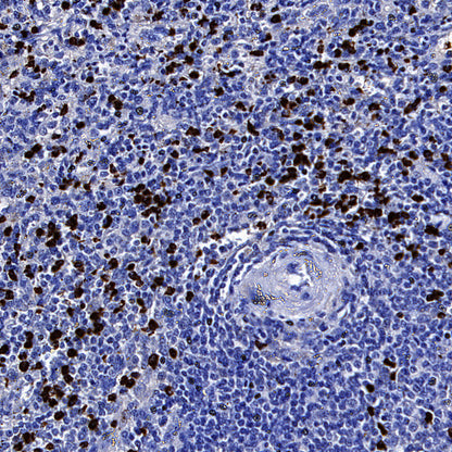 MMP-8 Recombinant Rabbit mAb (S-5674)