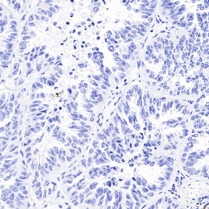 Keratin 17 Recombinant Rabbit mAb (SDT-011-43)