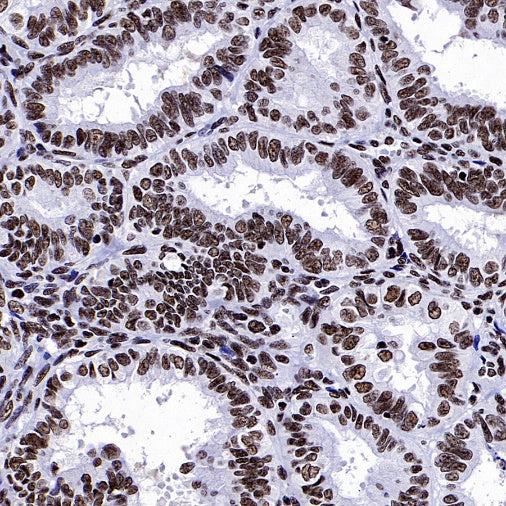 NRF1 Recombinant Rabbit mAb (S-2409-103)